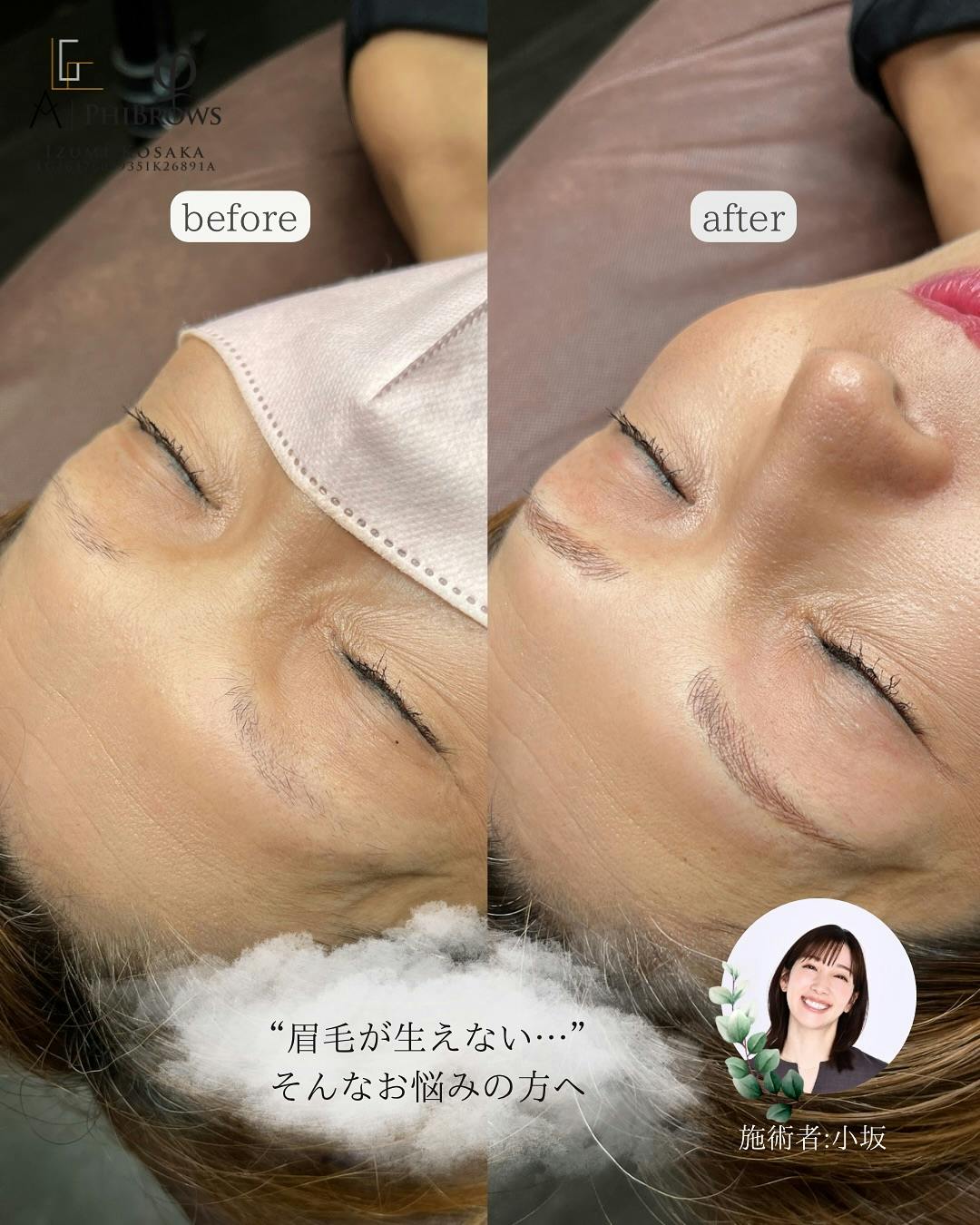 【女性・眉】眉のアートメイク_before_aftar