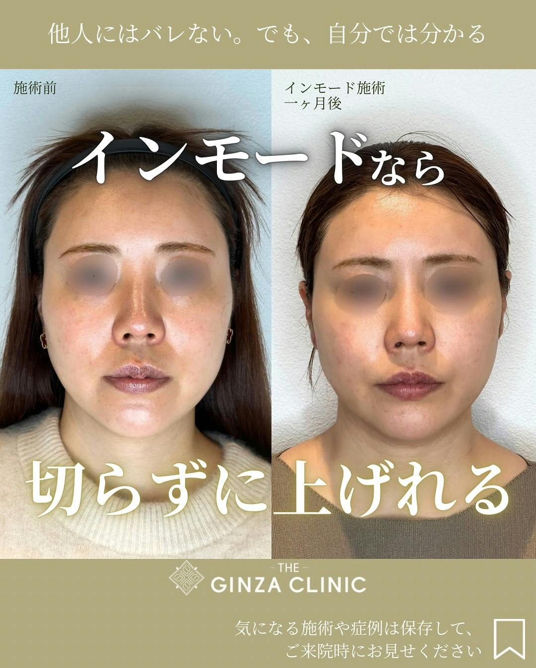 美品　Before・After 97％が実感！一撃ビフォアフター術 KAIZENBODY｜ビフォーアフター｜女性専門オールハンドトリートメント その他