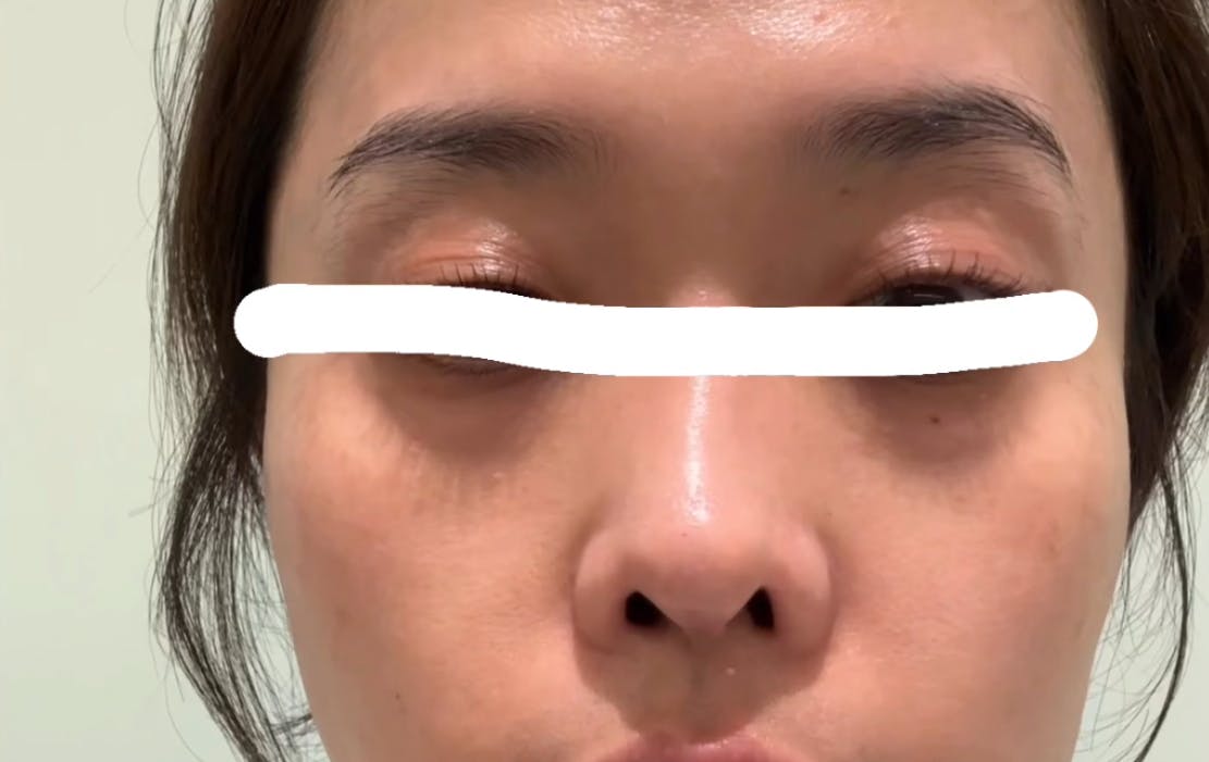 エースクリニック名古屋院/アネックス院でを受けたねむ子さんの写真