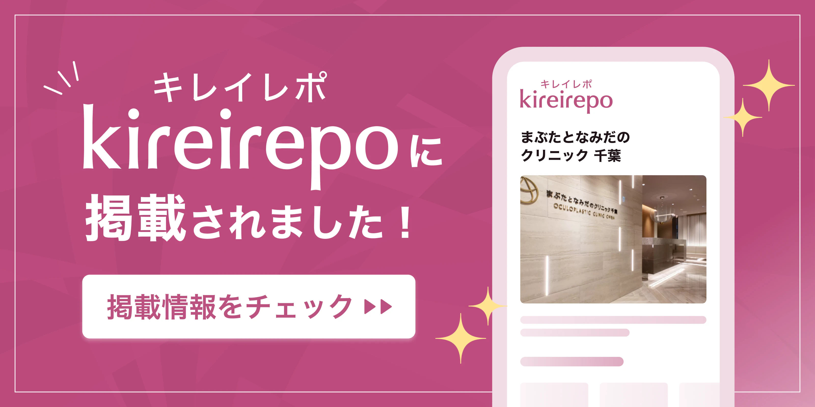 美容医療(自由診療・審美歯科)のプラットフォーム「キレイレポ」にまぶたとなみだのクリニック千葉が掲載されました。