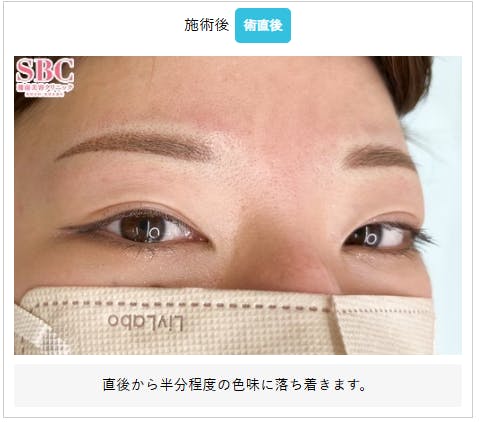 【女性・眉】眉毛_aftar