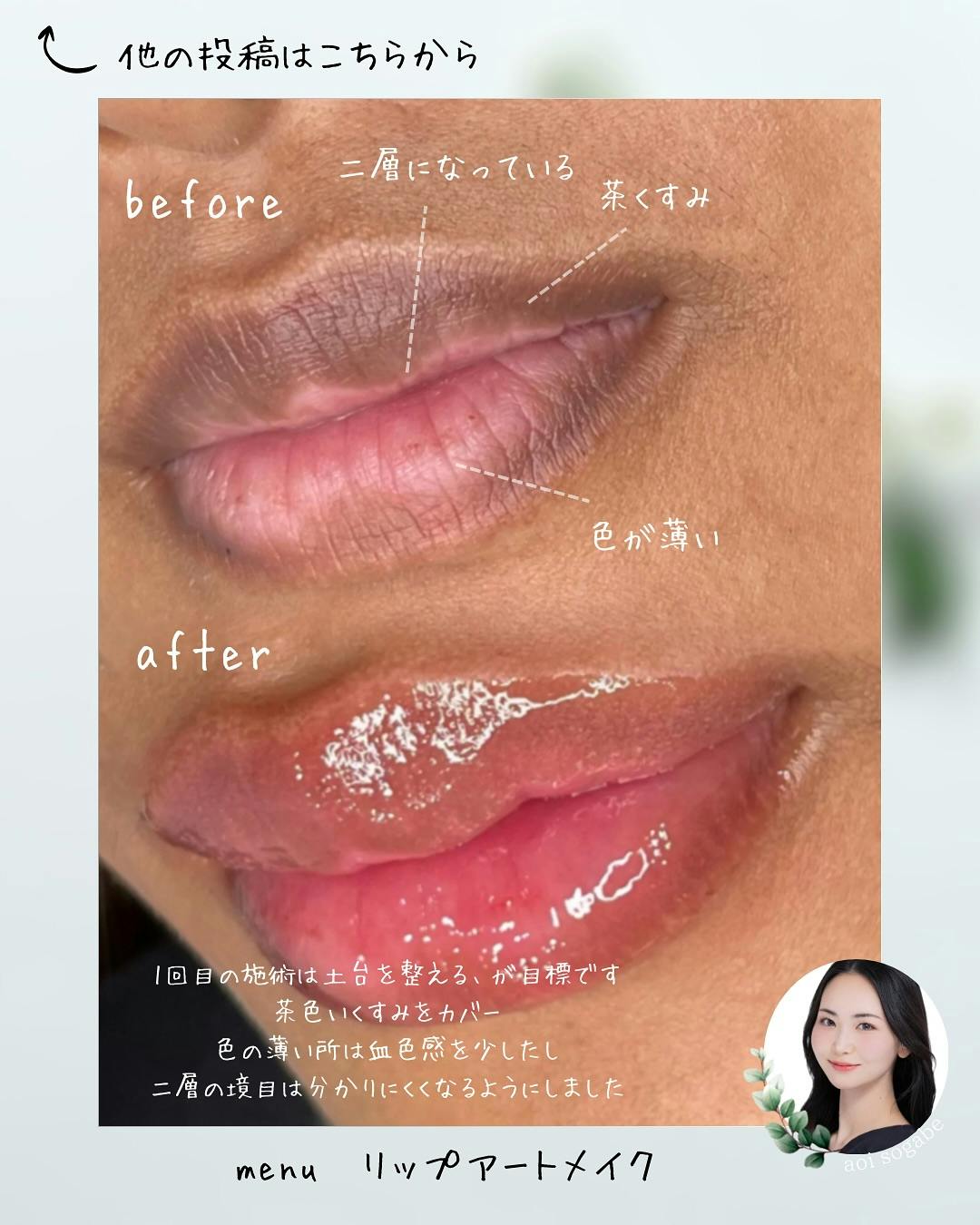 【女性・唇】リップアートメイク_before_aftar