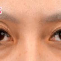 【30代女性・目元】クイックコスメティーク・ダブルNeo_before