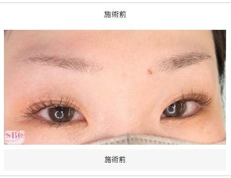 【女性・眉】眉毛_before