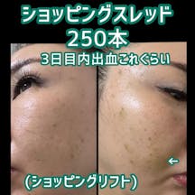 【女性・顔】ショッピングスレッド_before_aftar