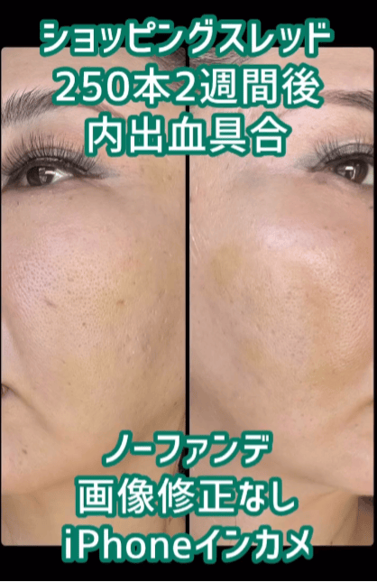 【女性・顔1】ショッピングスレッド_before_aftar