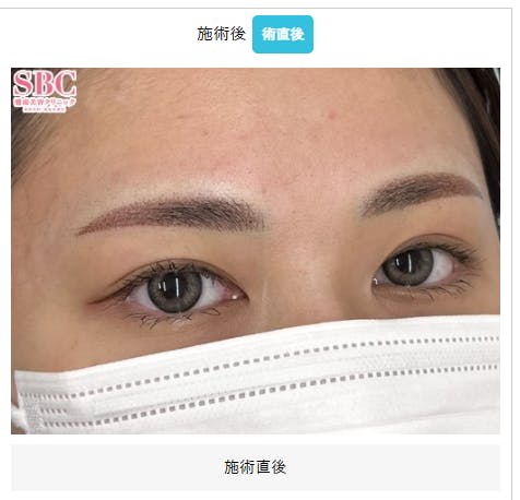 【女性・眉】mocci眉アートメイク（2Dパウダー）_aftar