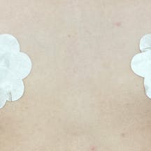 【女性・胸】Motivaエルゴノミックス2(バッグ豊胸)_before