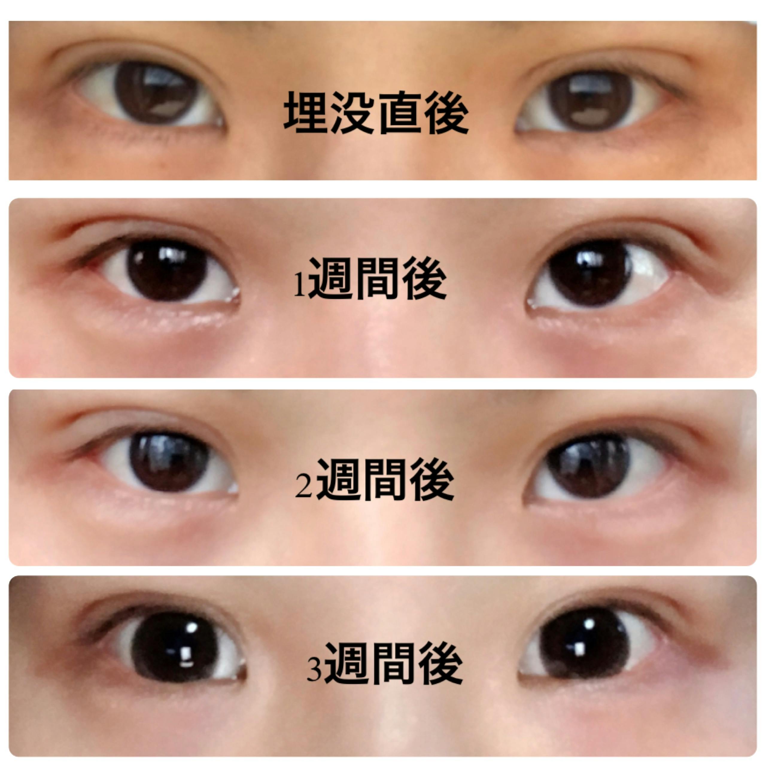 共立美容外科 名古屋院でを受けたじじさんの写真