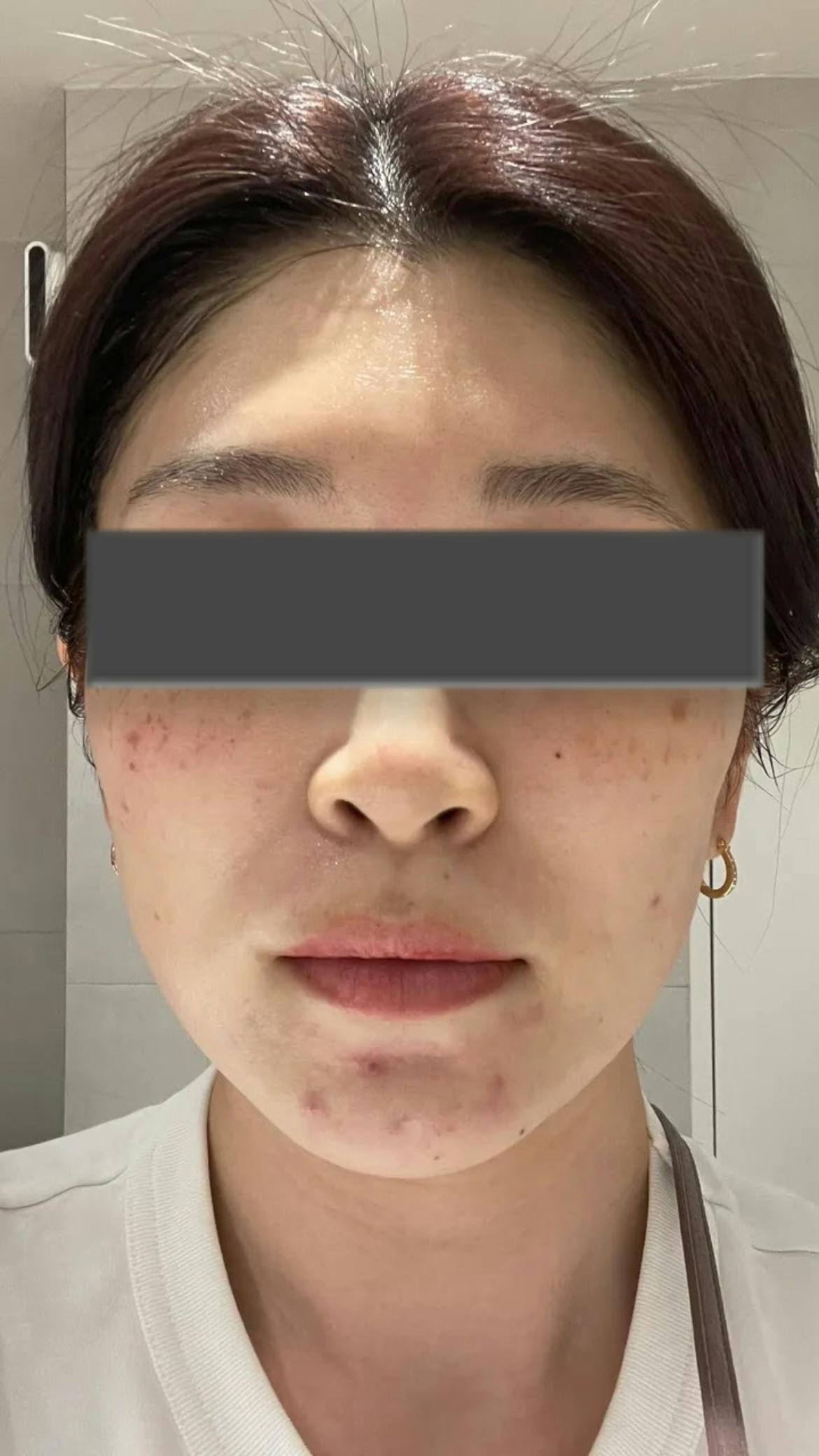 セニアクリニック(Xenia Clinic)本館でポテンツァを受けたまろにーさんの写真