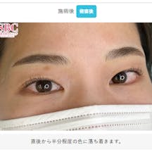 【女性・眉】眉毛_aftar