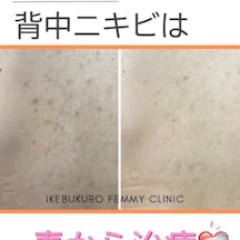 フェミークリニック 池袋院_before_aftar