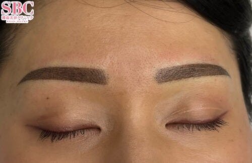 【女性・眉】アートメイク(眉毛)_after