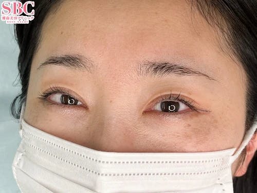 【女性・眉】mocci眉アートメイク（2Dパウダー）_before