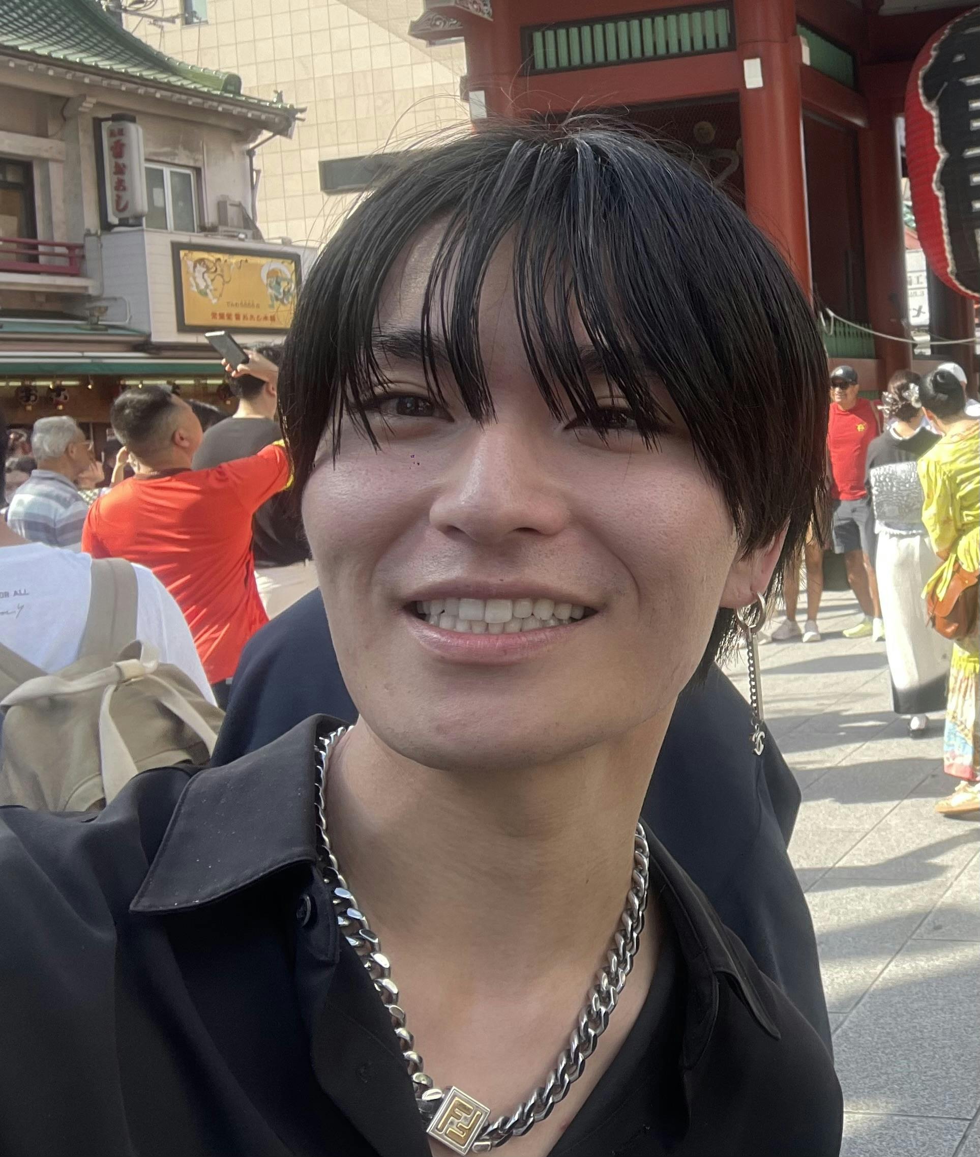 湘南美容クリニック 大阪梅田本院でボトックス注射・エラボトックス注射(小顔)・韓国製ボトックス・ボツリヌストキシン・アラガン製ボトックスを受けたRINさんの写真