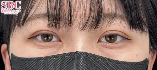 【20代女性・目元】クイックコスメティーク・ダブルNeo_aftar