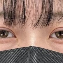 【20代女性・目元】クイックコスメティーク・ダブルNeo_aftar