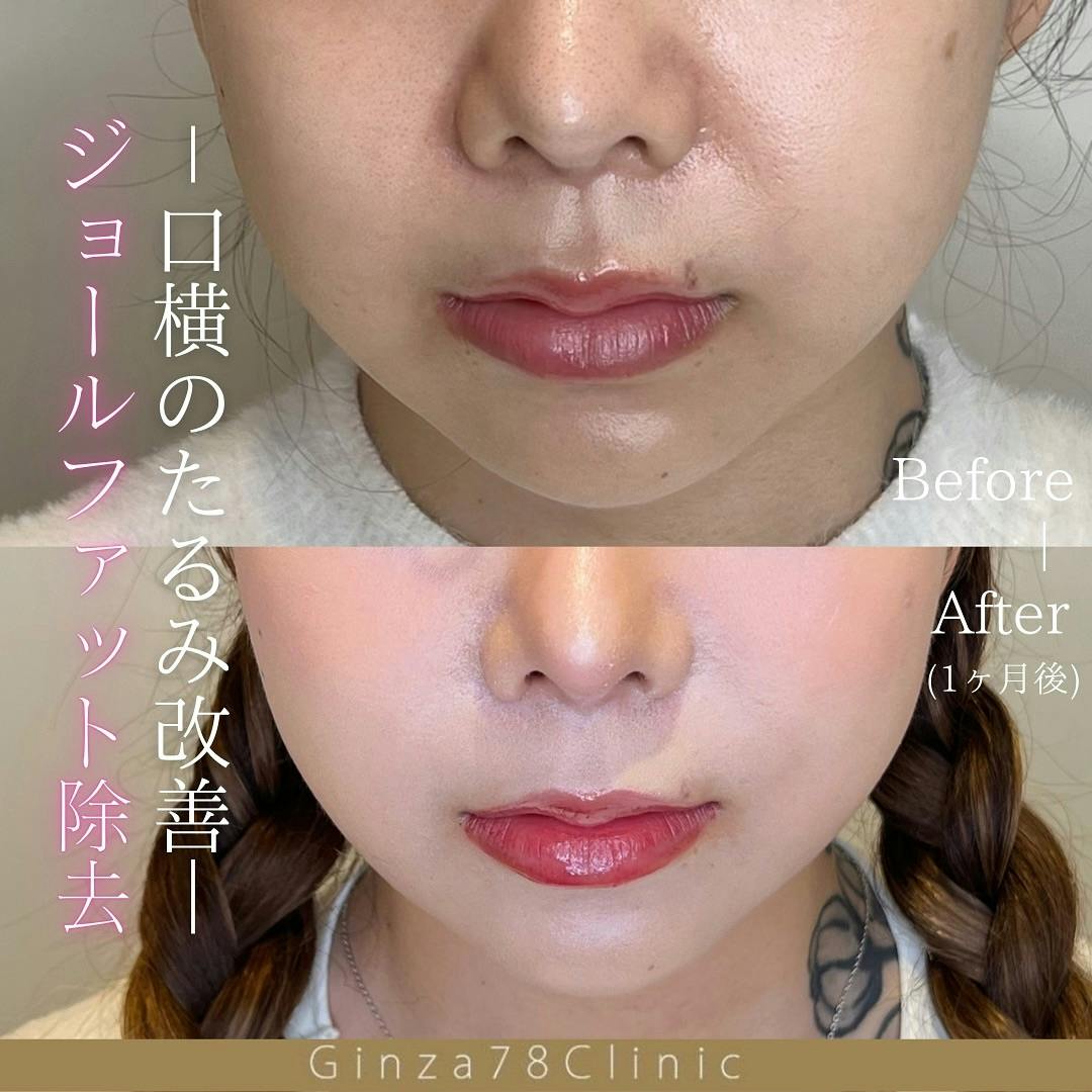 「Fascia Re:life」小顔調整法 セルフ小顔 予約のとれないエステティシャンが教える一生使える