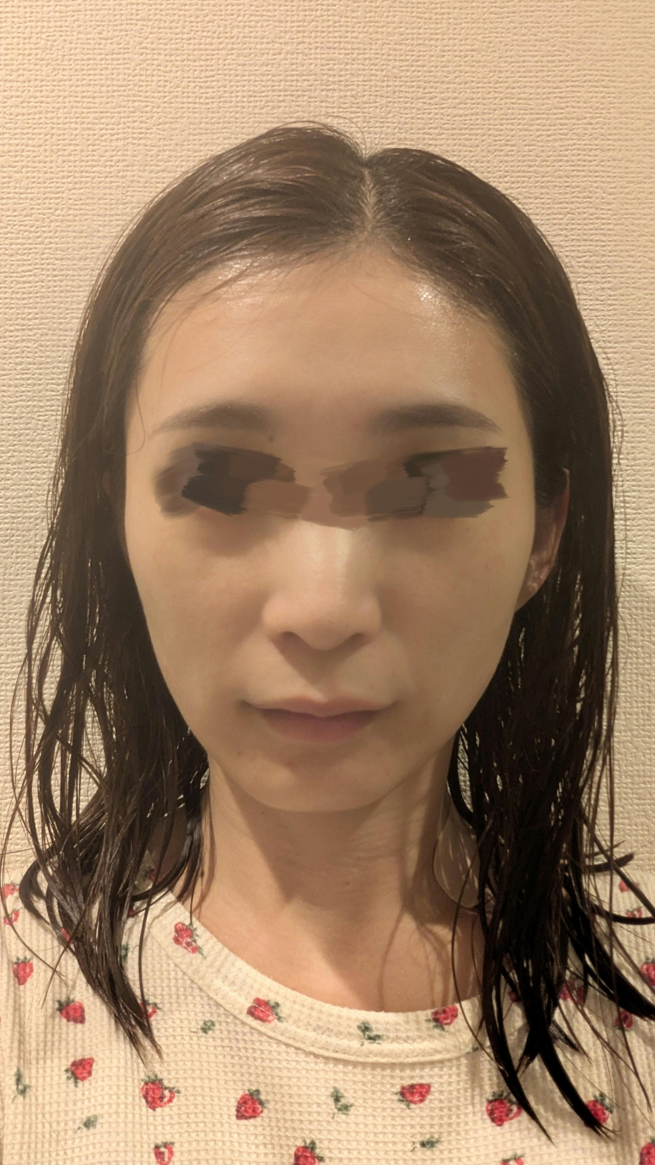 あやクリニックでショッピングリフトを受けたハッピーさんの写真