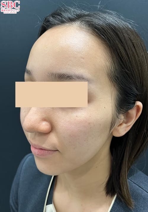 湘南美容クリニック 岐阜院_after