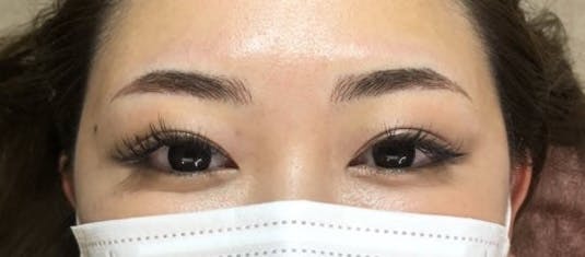 表参道メディカルクリニック 銀座院で眉アートメイクを受けたさおりさんの写真