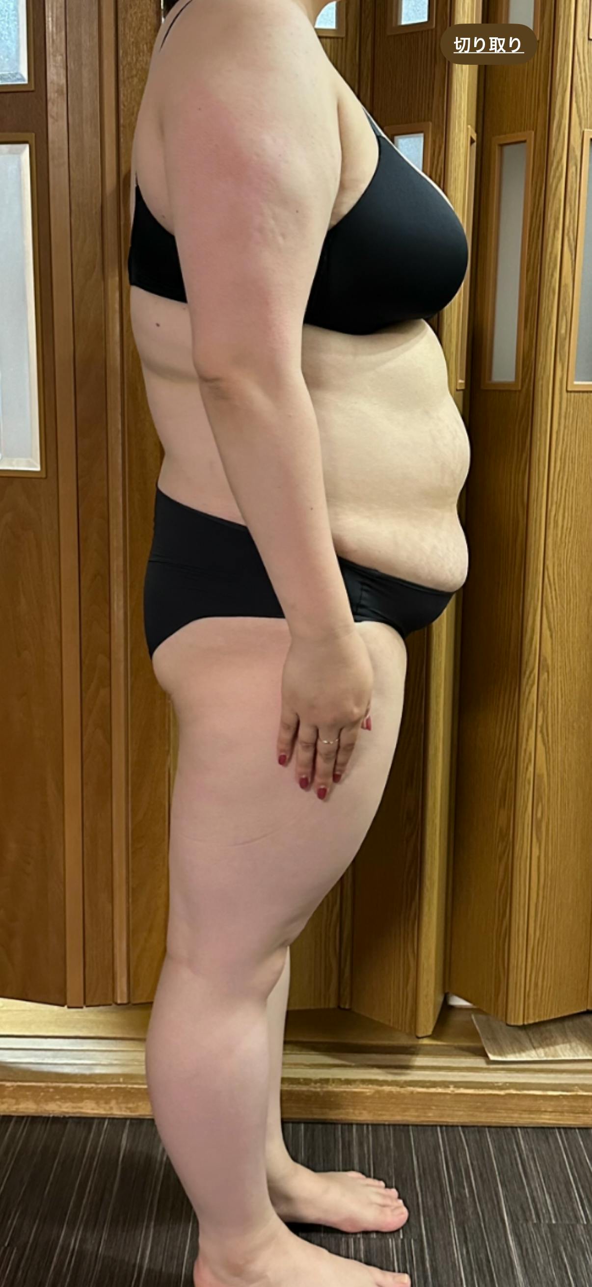 湘南美容クリニック 大阪梅田本院で医療痩身・ダイエット・ダイエットピル(痩身内服薬)を受けたnaagiiさんの写真