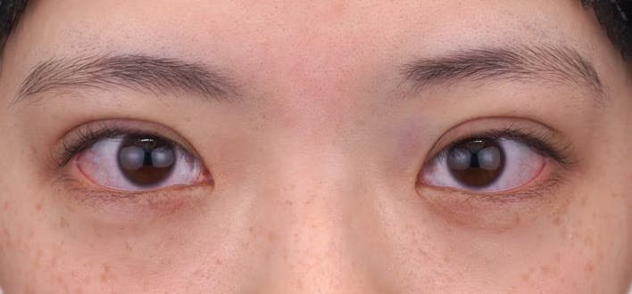 【10代女性・目元】クイックコスメティーク・トリプルNeo_0day