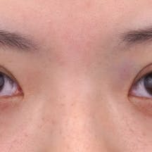 【10代女性・目元】クイックコスメティーク・トリプルNeo_0day