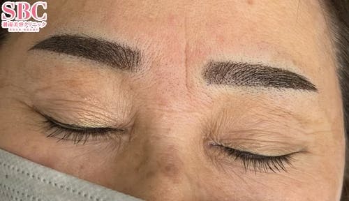 【女性・眉】アートメイク(眉毛)_after