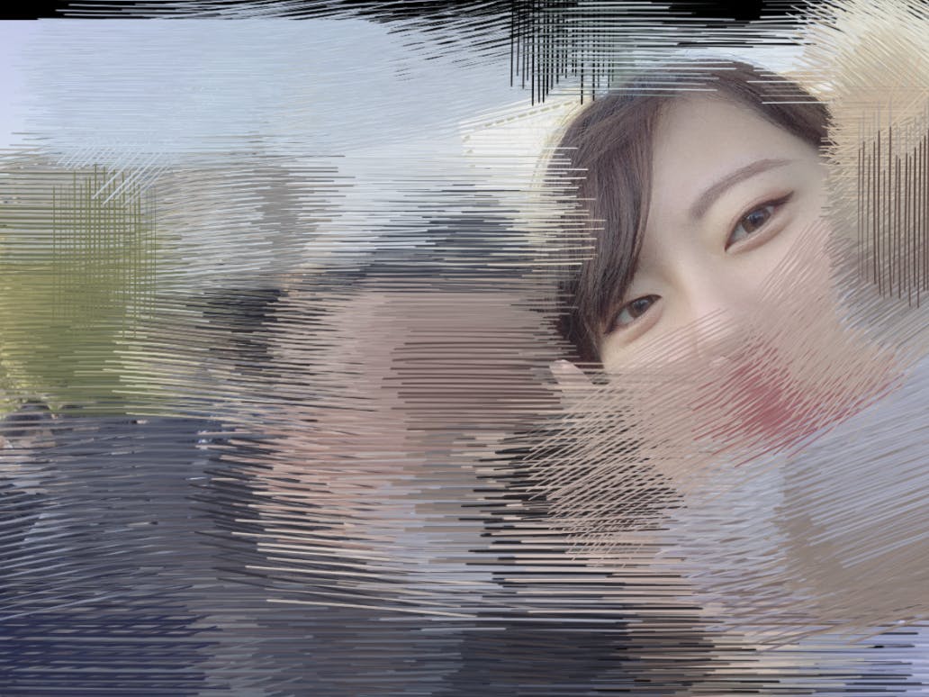 湘南美容クリニック 大阪駅前院で二重整形・二重埋没・奥二重整形・末広二重整形・平行二重整形・ミックス型二重整形・目元整形を受けたゆったさんの写真