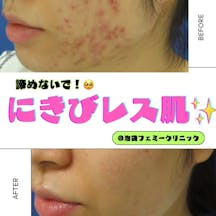 フェミークリニック 池袋院_before_aftar