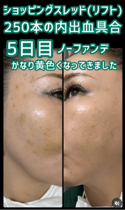 【女性・顔】ショッピングスレッド_before_aftar