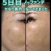 【女性・顔】ショッピングスレッド_before_aftar