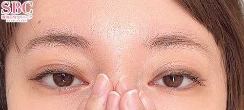 【女性・眉】アートメイク(眉毛)_before