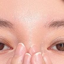 【女性・眉】アートメイク(眉毛)_before