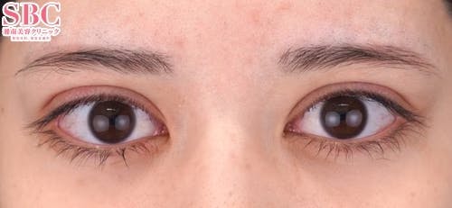 【20代女性・目元】クイックコスメティーク・トリプルNeo_0day