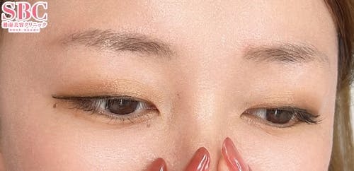 【女性・眉】アートメイク(眉毛)_before