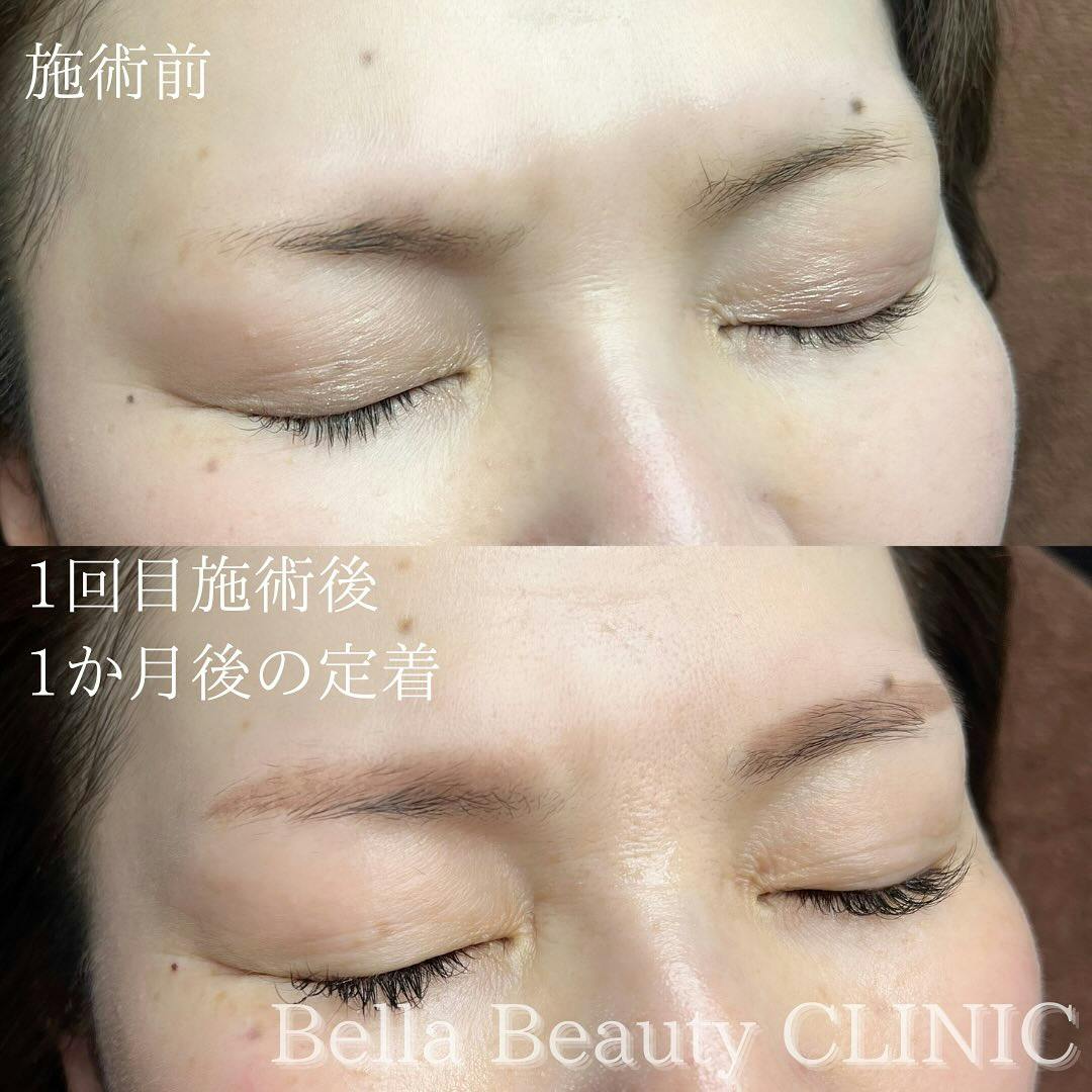 【女性・眉】パウダーアートメイク(2D)_before_aftar