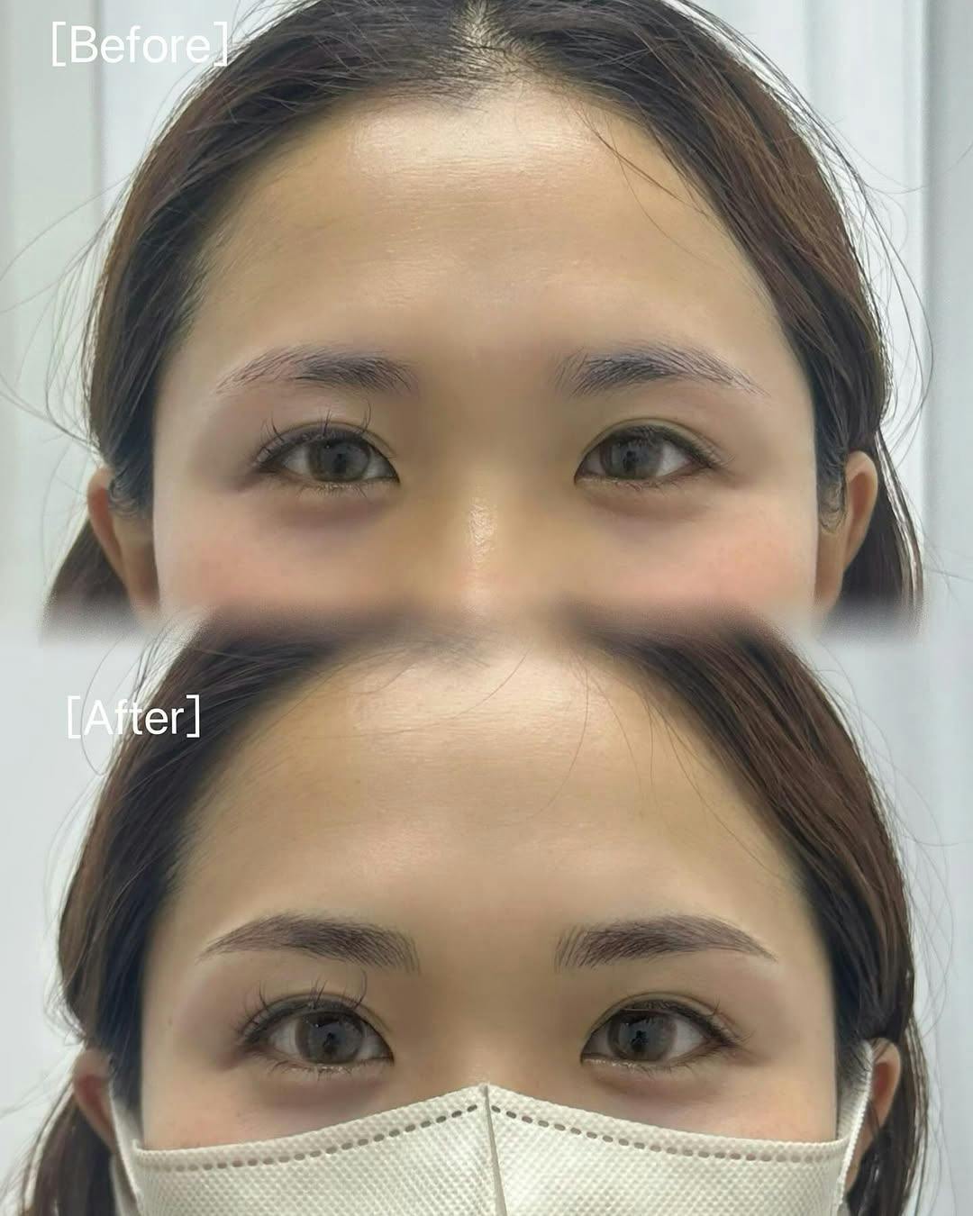 【女性・眉】アートメイク(眉)_before_aftar