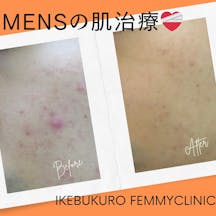 フェミークリニック 池袋院_before_aftar