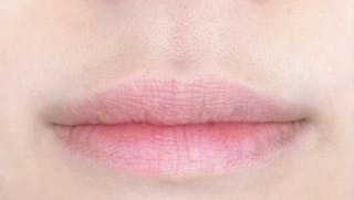 ルラ美容クリニック 広島院でCカールリップを受けたてぃさんの写真