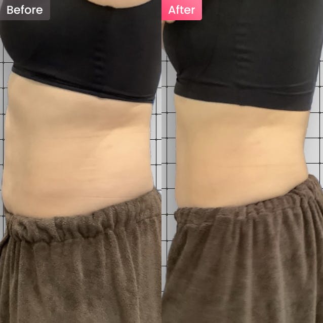 【女性・引き締め】お腹を引き締めたいの写真