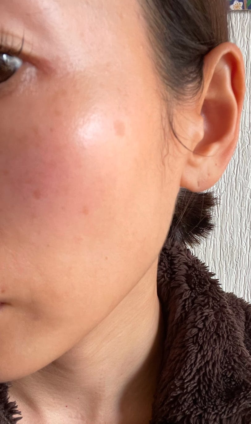 湘南美容クリニック 藤沢院でを受けたKazuminさんの写真