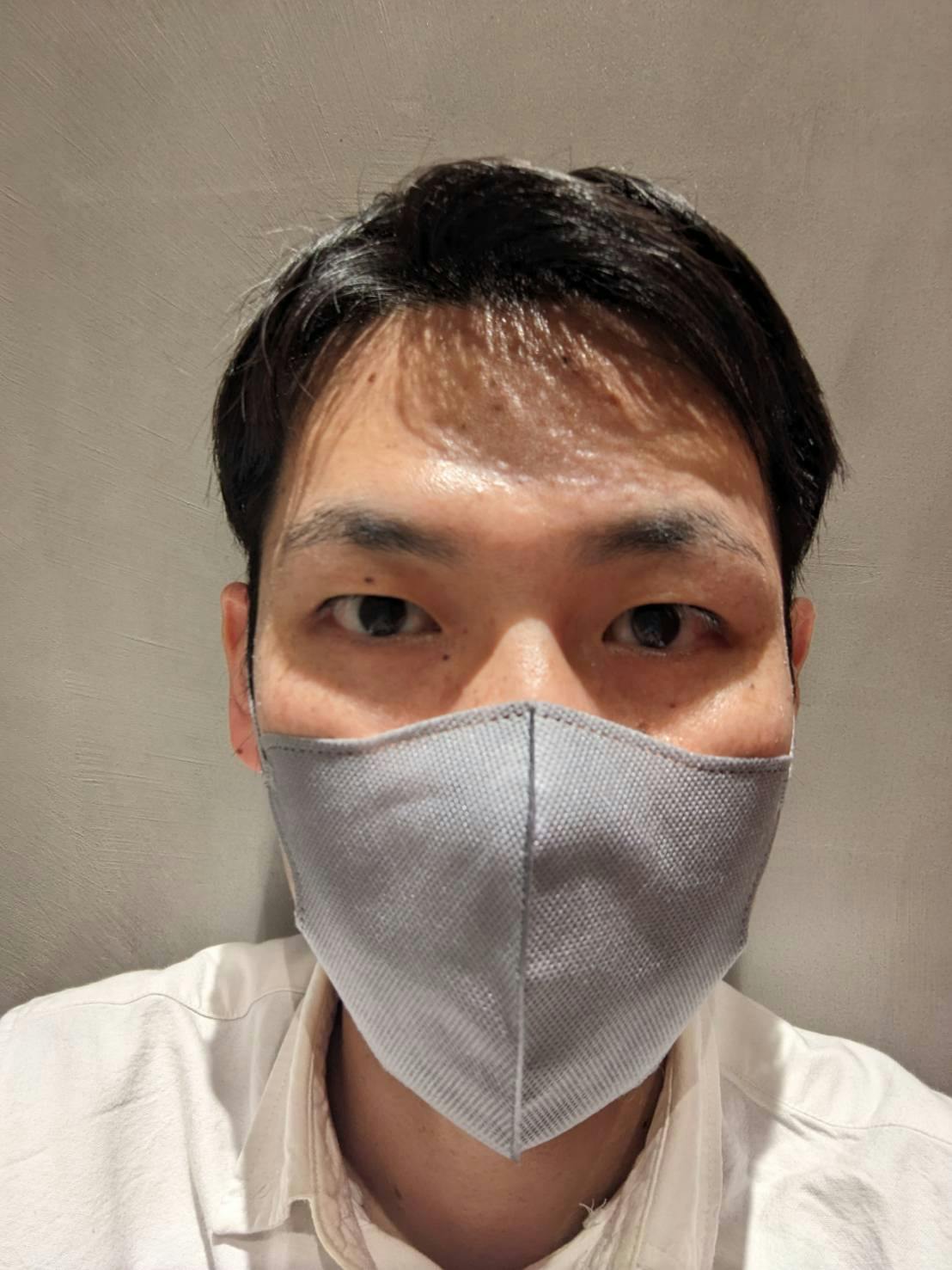 Dクリニック福岡でアートメイクを受けたやんぴんさんの写真