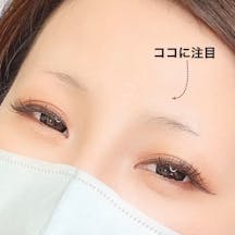 【女性・眉毛】アートメイク_before