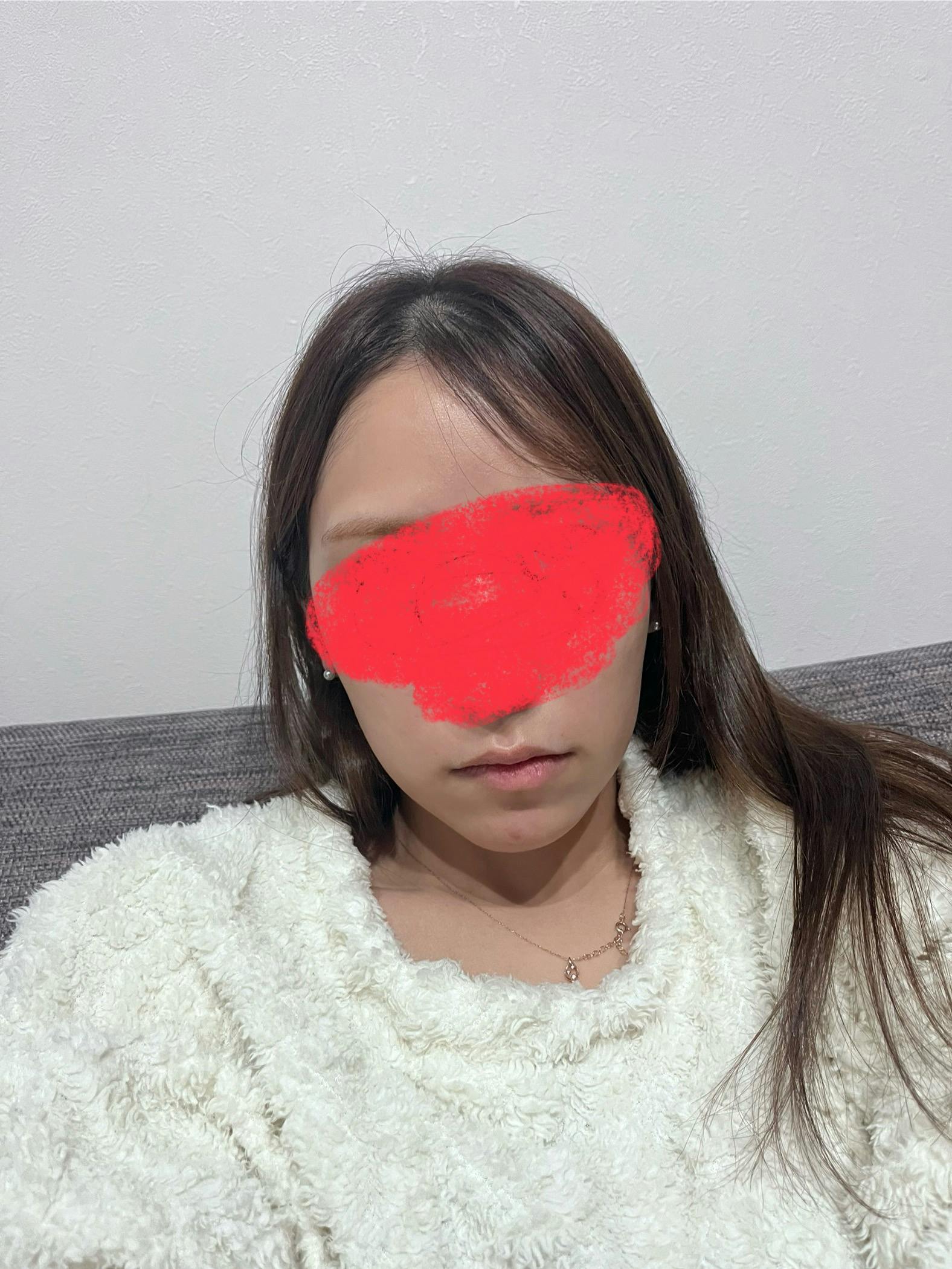 モーブビューティークリニック札幌大通(Mauve Beauty Clinic 札幌大通)でリップアートメイク・唇アートメイクを受けたelleriさんの写真