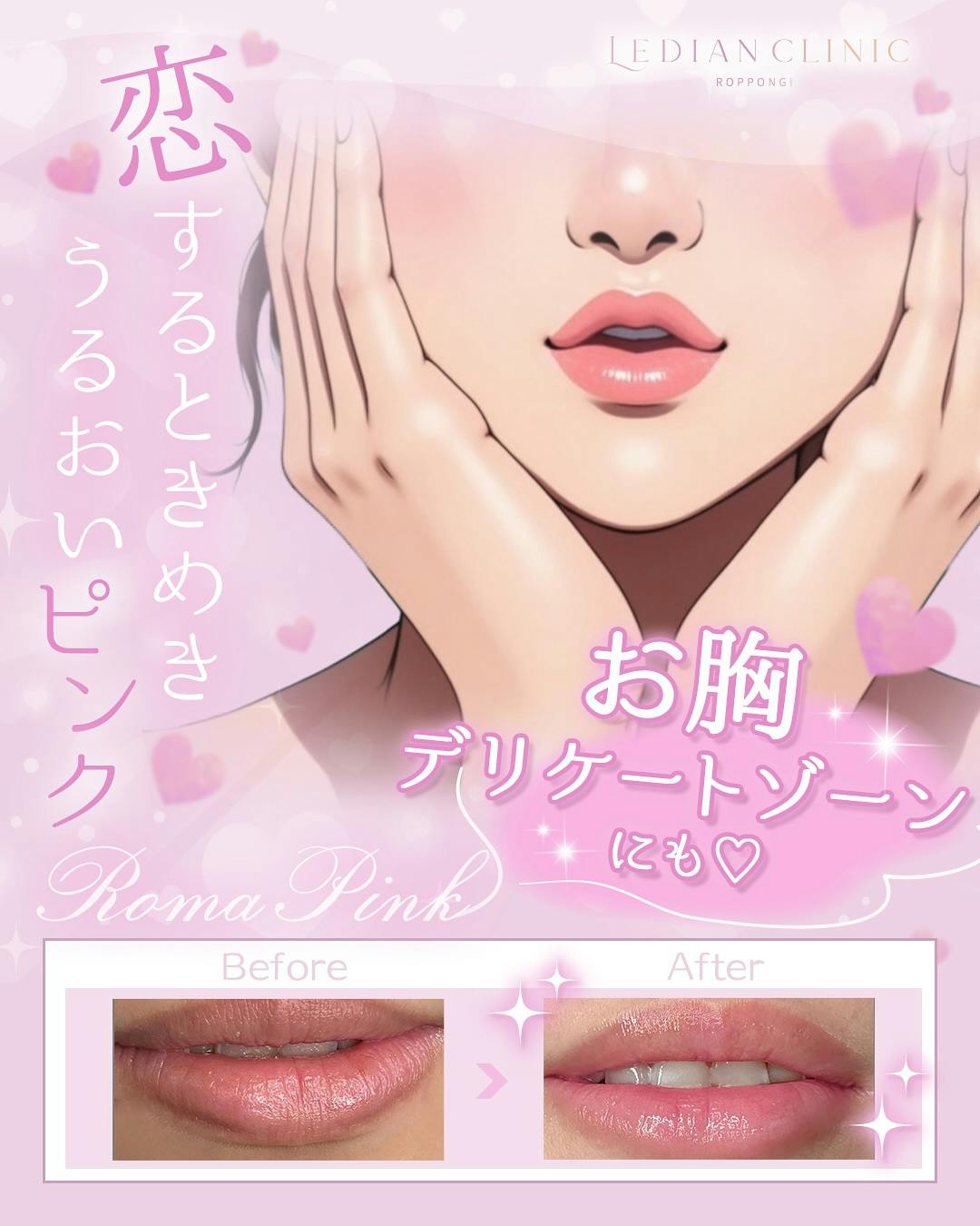 【女性・唇】ローマピンク_before_aftar