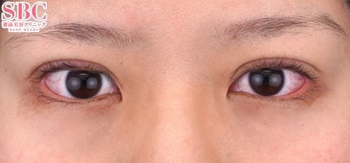 【20代女性・目元】クイックコスメティーク・ダブルNeo_0day