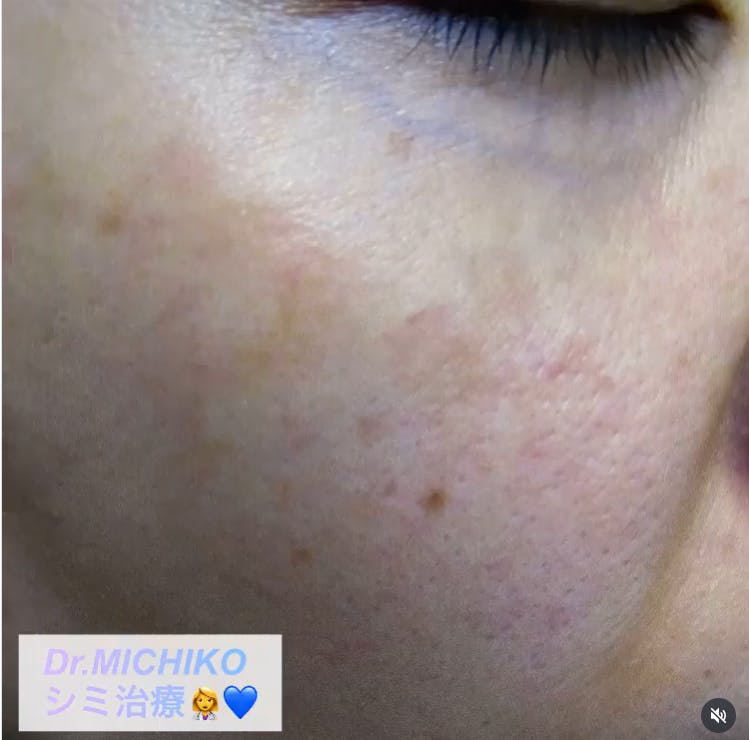 フェミークリニック 池袋院_after