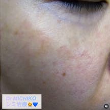 フェミークリニック 池袋院_after